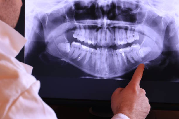 Best Broken Tooth Emergency  in Mountain City, TN